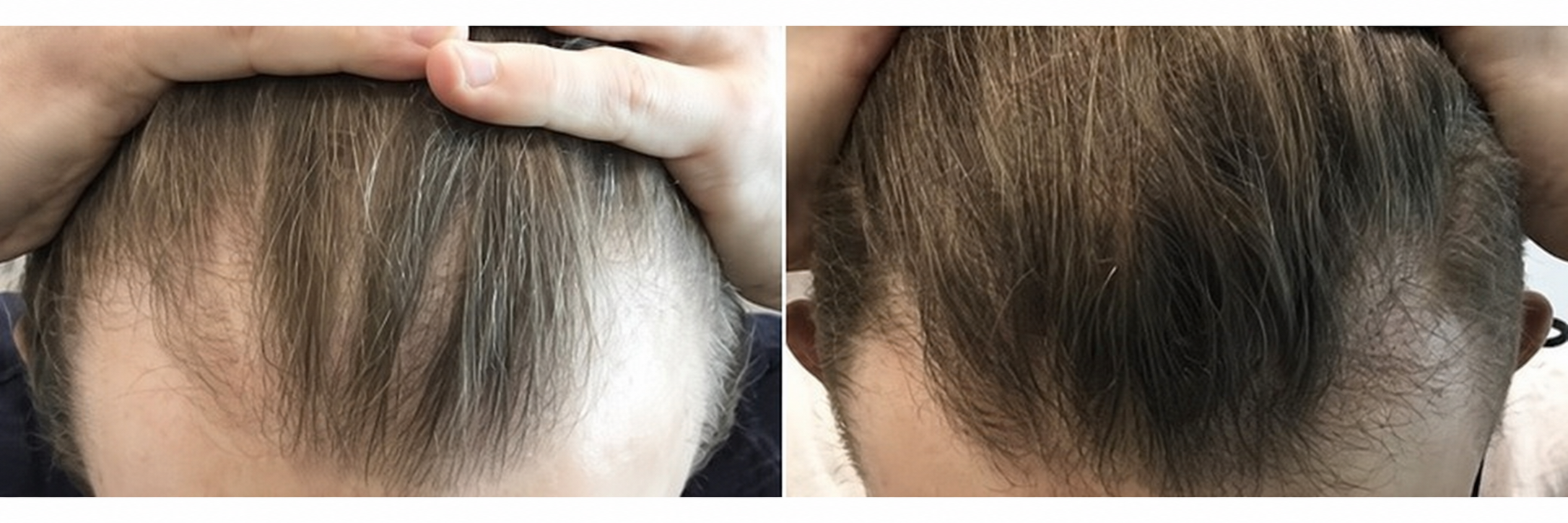 AI-edited illustration based on a supplied hair comparison