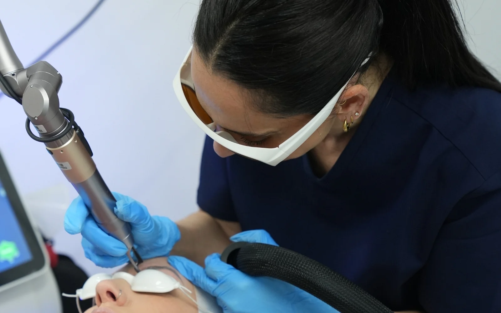 Practitioner performing laser tattoo removal, with protective eyewear worn